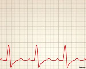 Cardiology rhythm Power Point Template